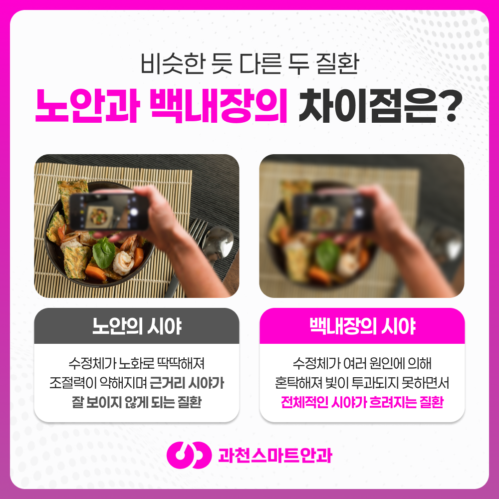 과천노안백내장 안내 이미지 2