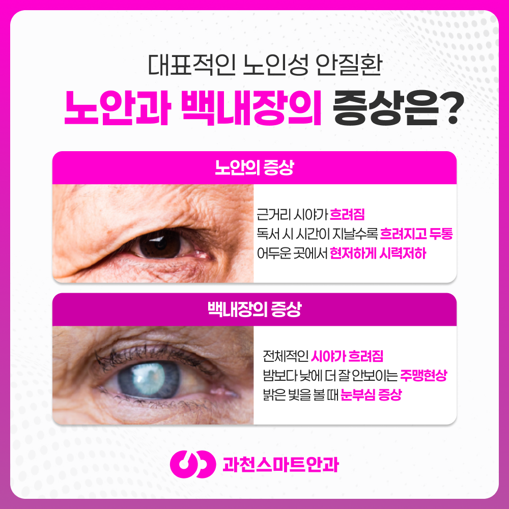 과천노안백내장 안내 이미지 3