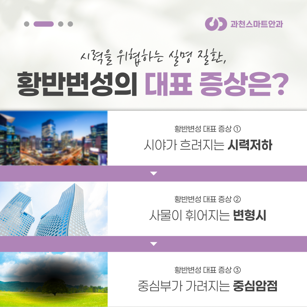 과천황반변성안과 습성 건성 황반변성 비교 이미지