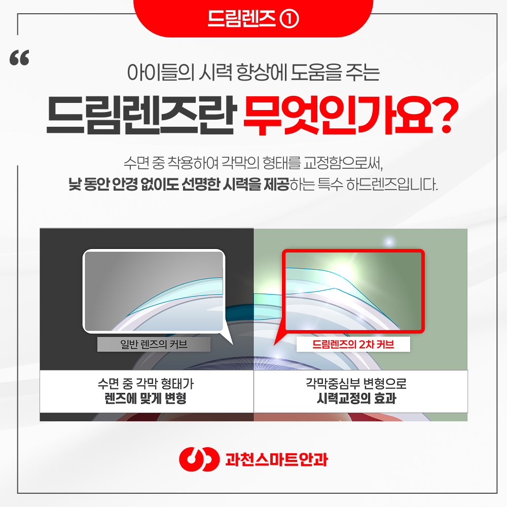 과천안과 각막지형도 정밀검사 이미지