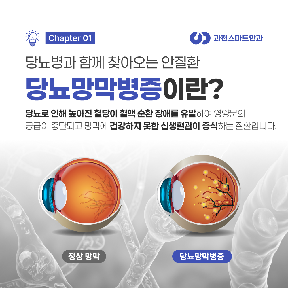 과천당뇨망막병증 정밀검사 안내 이미지